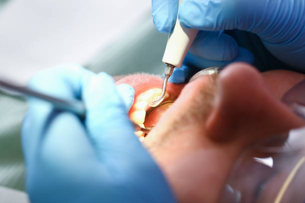 Best Broken or Cracked Tooth Emergency Dentist in Canadian Lakes, MI