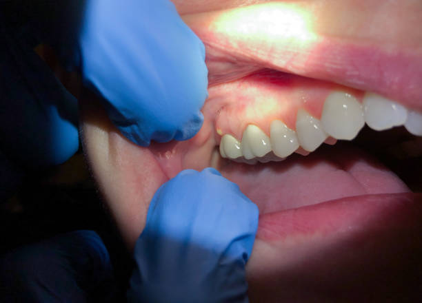 Best Pediatric Emergency Dentist in Canadian Lakes, MI