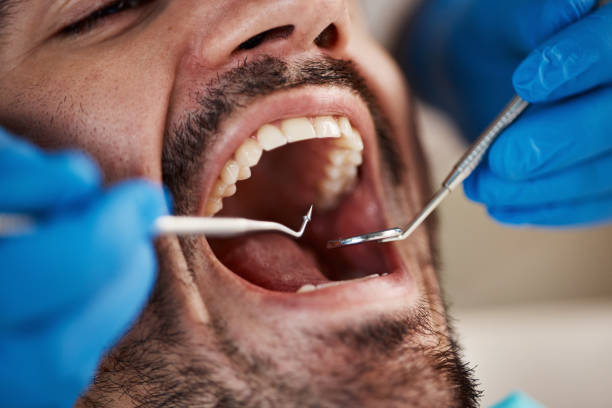 Best Urgent Dental Care for Toothache in Canadian Lakes, MI